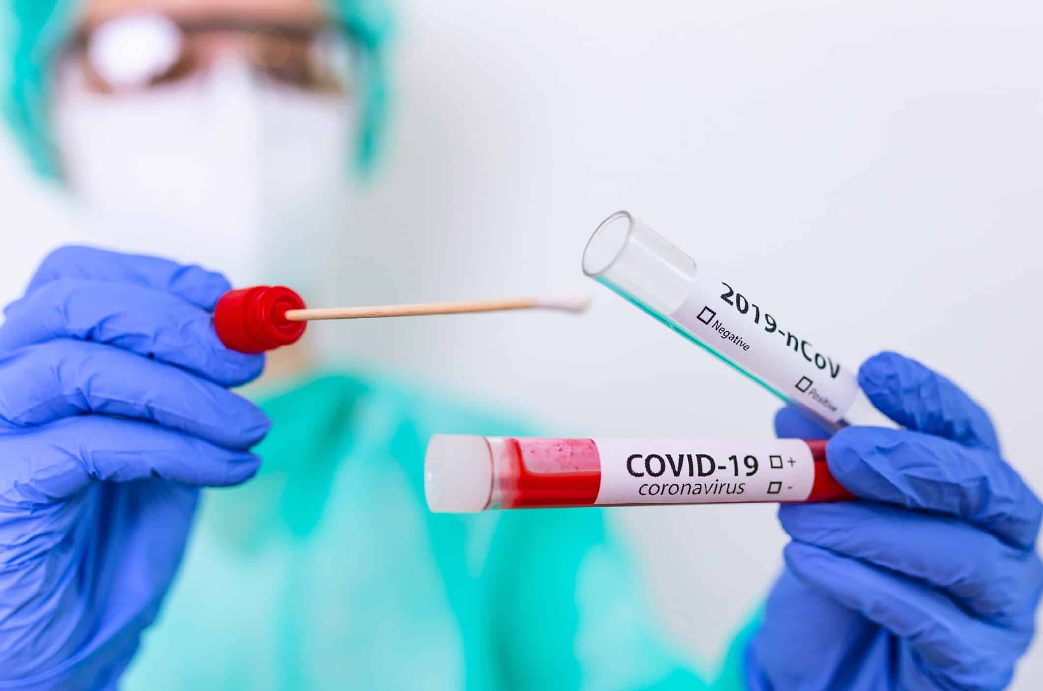 Tamponi gratis Milano