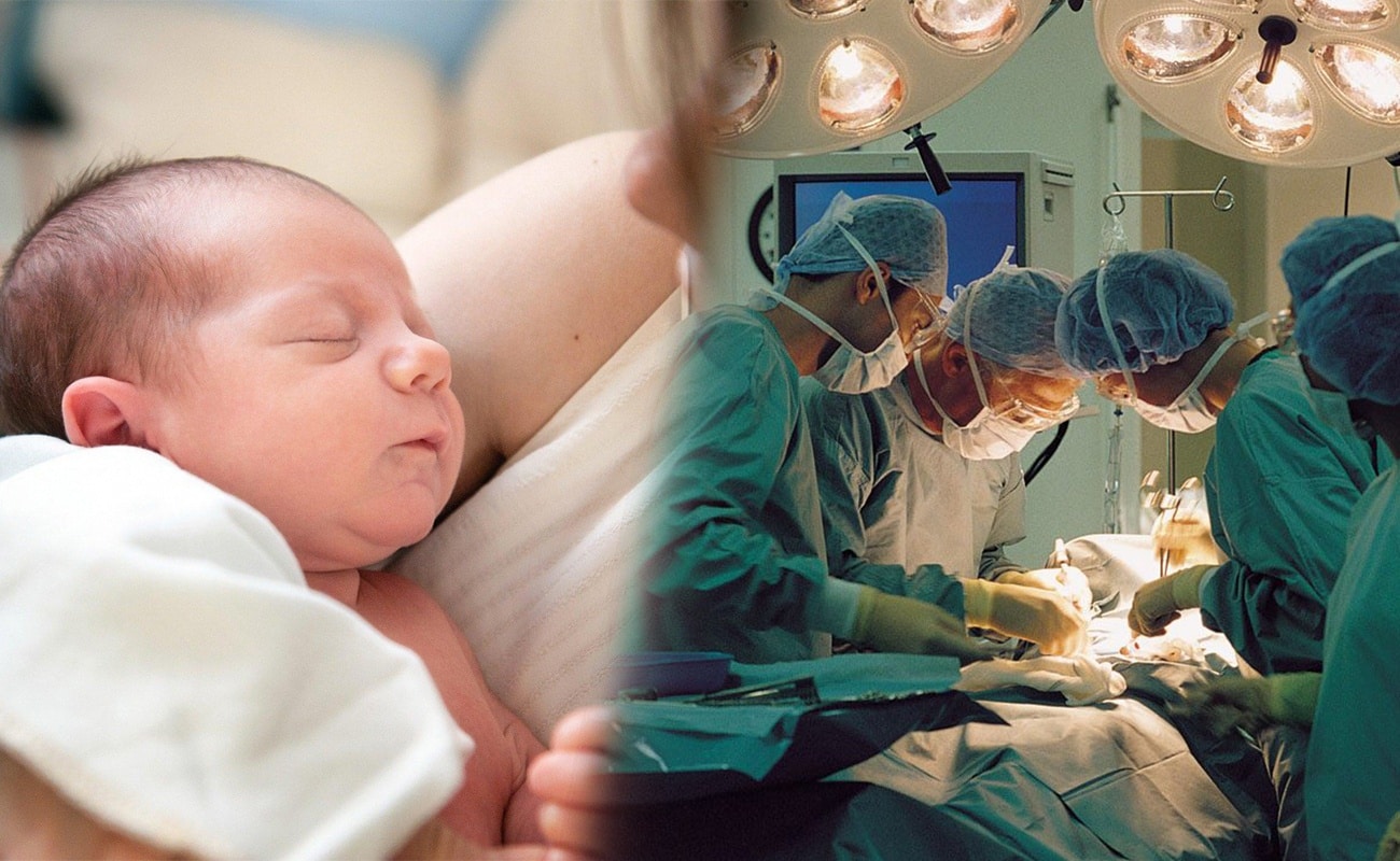 Bambina con una malformazione alla mano, viene operata a un giorno di vita. L’impresa del Policlinico di Milano