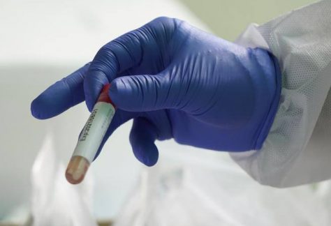 test sierologico anticorpi