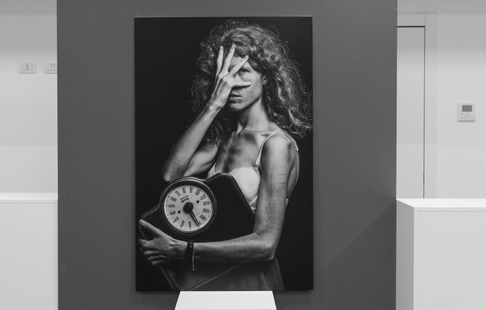 mostra fotografica disturbi alimentari