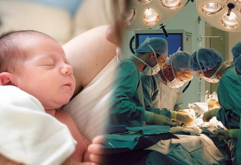 bambina malformazione mano